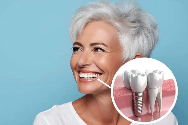 Dental İmplant