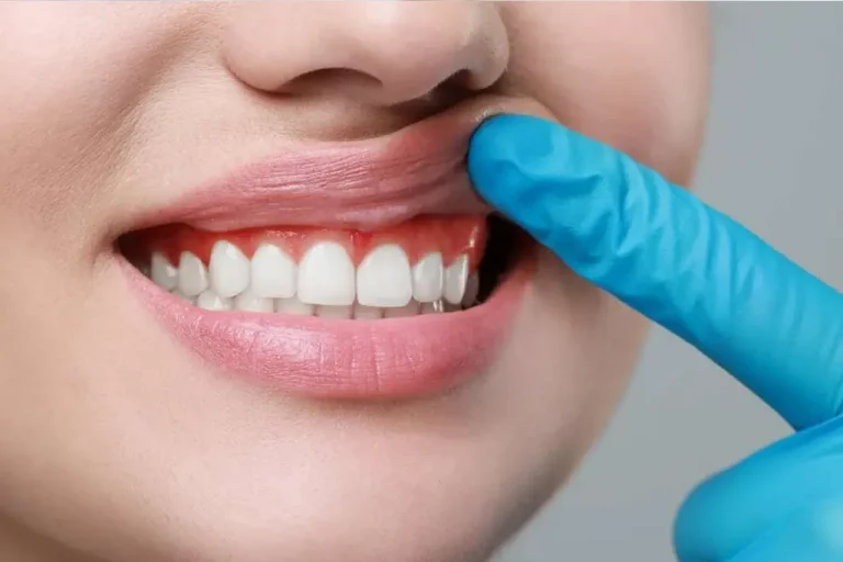 Periodontoloji